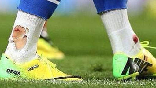 hazard